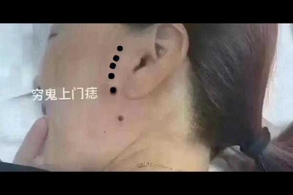 鬼谷痣相风水学—越隐秘的痣越好吗