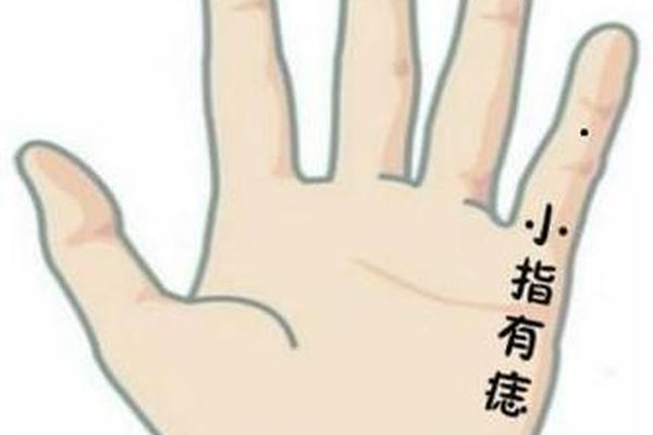男人右手无名指上有痣相—右手无名指长了个痣