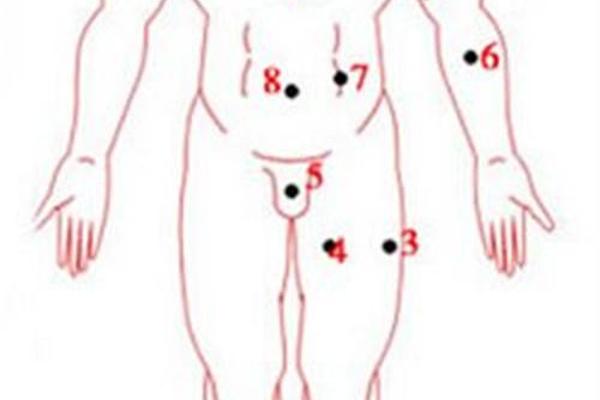 女人全手痣相大全图解_手上痣相图解大全