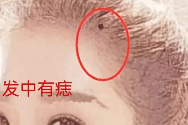 必定巨富的痣相-巨富痣大概在什么位置
