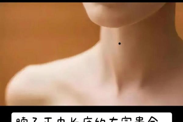 痣相 脖子正下方有痣,颈部下方长痣代表什么