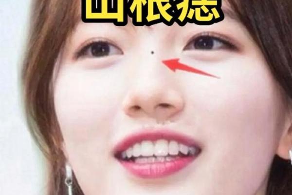 女相山根有痣_山根旁边有痣