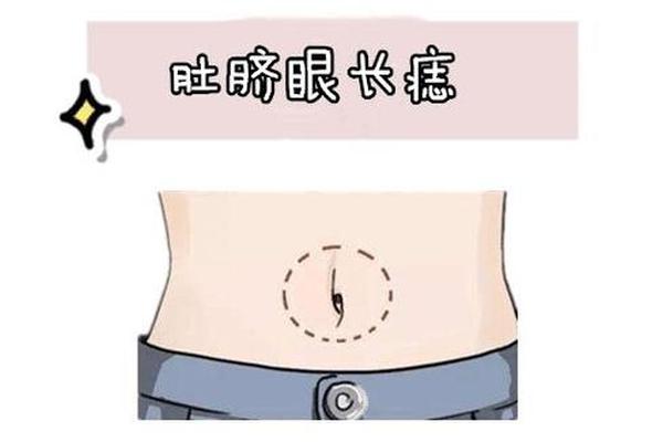 肚子 痣相;肚子痣图片