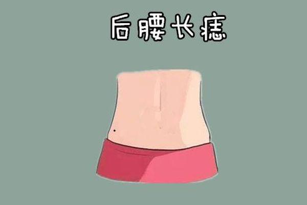 女子腰部痣相-腰部长痣代表什么图解
