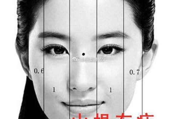 山根两侧的痣相 山根有痣图片