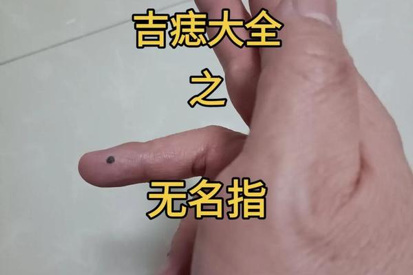 痣相女人手指相图解(女人手指侧面长痣图解)
