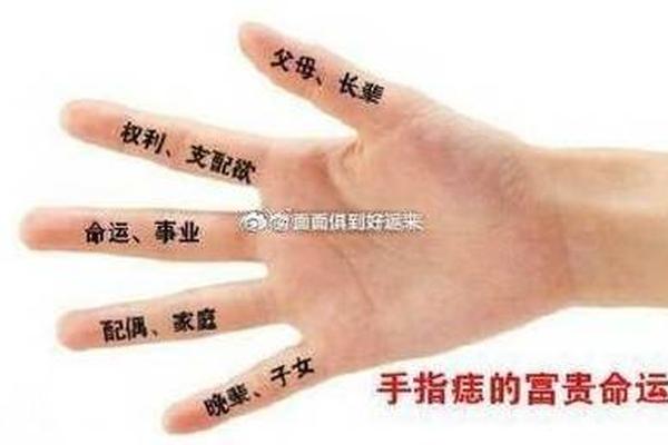 痣相手指有痣_手掌痣相图解 痣相手指有痣_手掌痣相图解