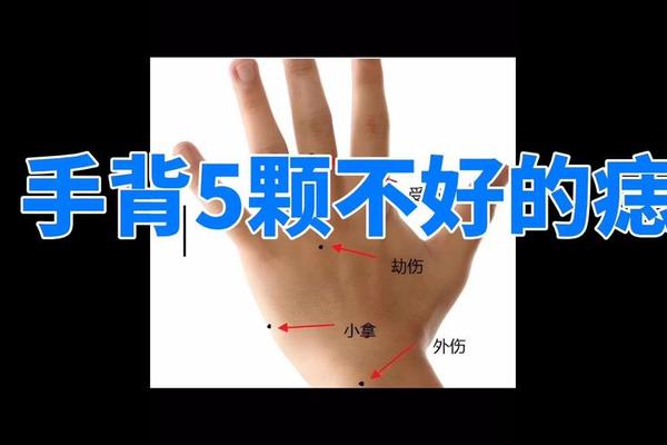 手背上痣相;手指背面有痣代表什么