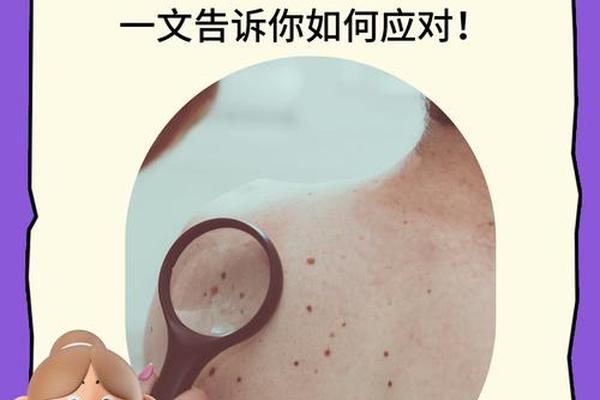 后背长痣图解痣相、后背长痣代表什么