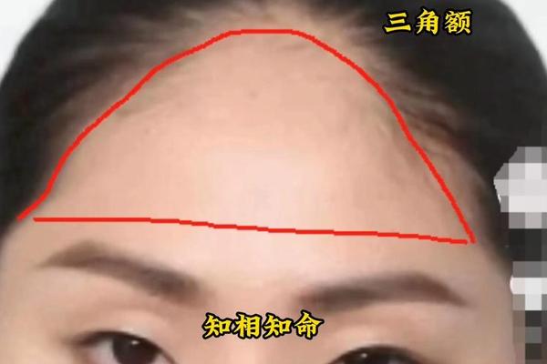 痣相风水中的三角痣 面部三颗痣呈现三角形