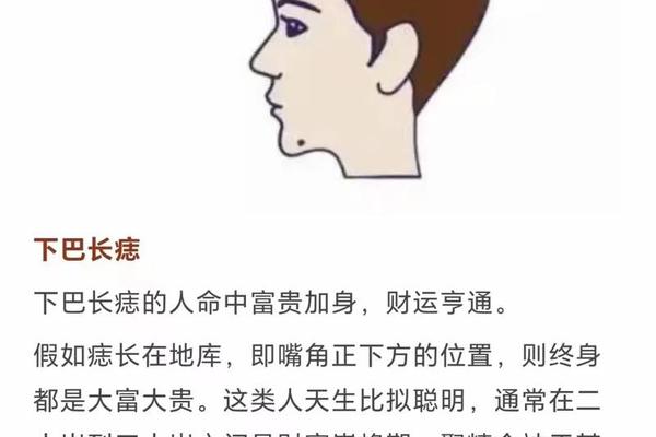 女性下巴痣的位置吉相—女人下巴长痣的位置图解 女性下巴痣的位置吉相—女人下巴长痣的位置图解