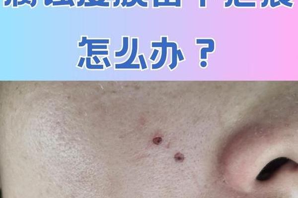 点痣苏州相城_苏州去痣医院排名前三的