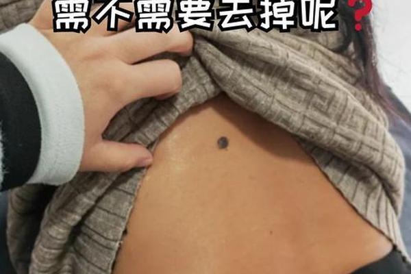 长在后背腰上的痣相—腰背有痣图解大全