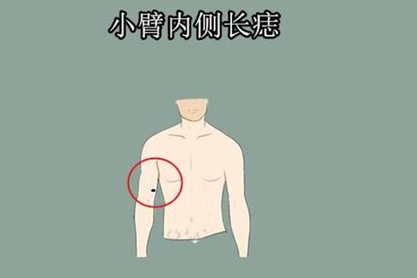 会看手臂痣相的主播;手臂内侧的痣图解