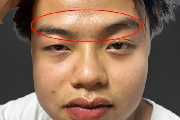 麻衣神相眉毛长痣—眉毛有痣是好是坏
