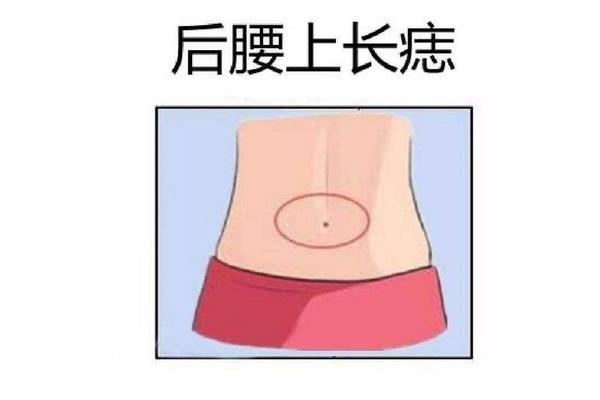 女人腰上有痣富相(女人富痣什么意思)