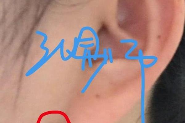 男人耳垂有痣相最准图—高人说耳垂痣