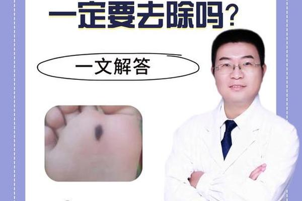 脚上痣相不好怎么办 脚底有痣图解_痣相解析 脚上痣相不好怎么办 脚底有痣图解_痣相解析