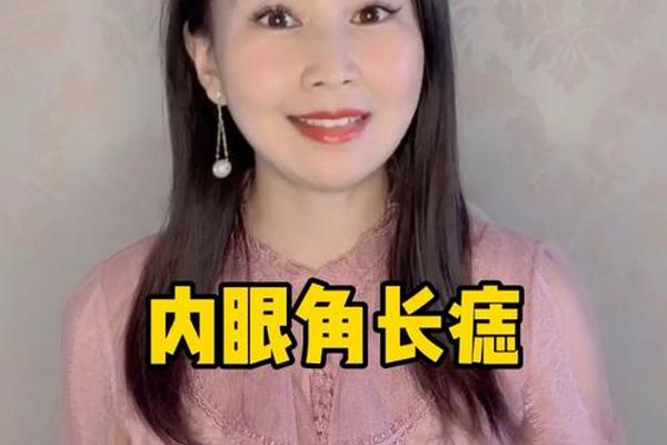眼角里面痣相、眼角里有颗痣叫什么痣