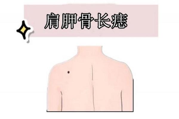 男性肩胛骨有痣 痣相—男人左肩胛骨有痣图解