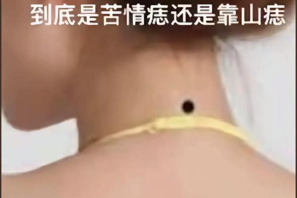 项后有痣女相_后颈有痣的女人好不好