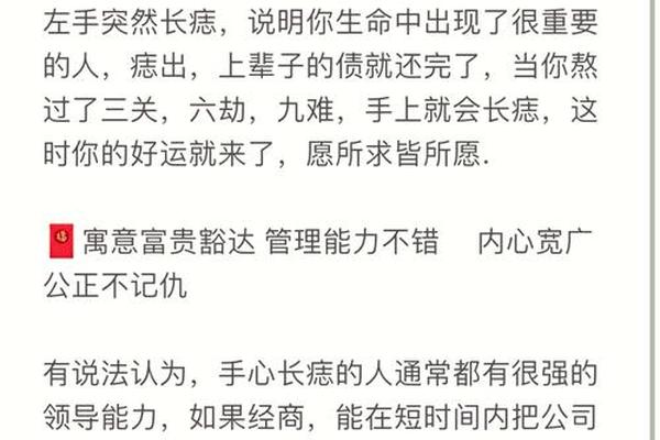 手板痣相、手掌心有痣的寓意