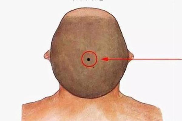 痣相男头顶;男头顶有痣命运