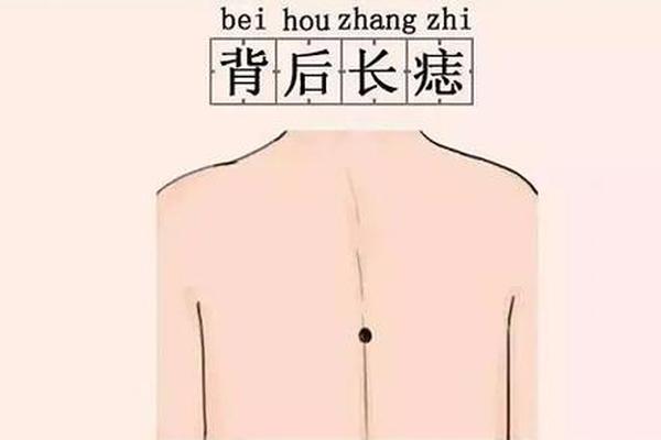 痣相身体背部 后背有痣代表什么
