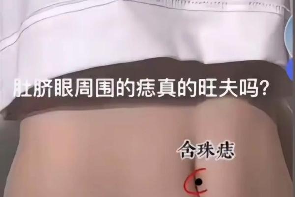 肚脐上有痣的富相—肚脐中含珠痣