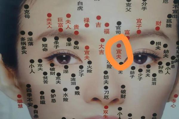 周围长痣是吉相吗,周围长痣看相