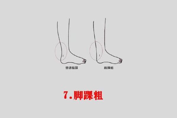 左小腿外侧痣相,左小腿有痣的女生全部图解