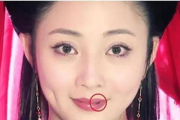 女孩嘴唇有痣是什么相—女孩子嘴唇上长痣