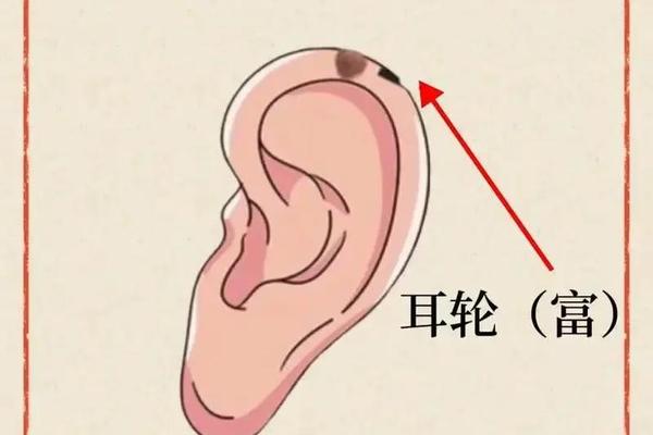耳朵根有痣相-耳朵哪里的痣有福气图
