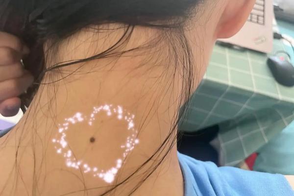女人脖子后面痣相最准图 女人颈部四个痣相图解