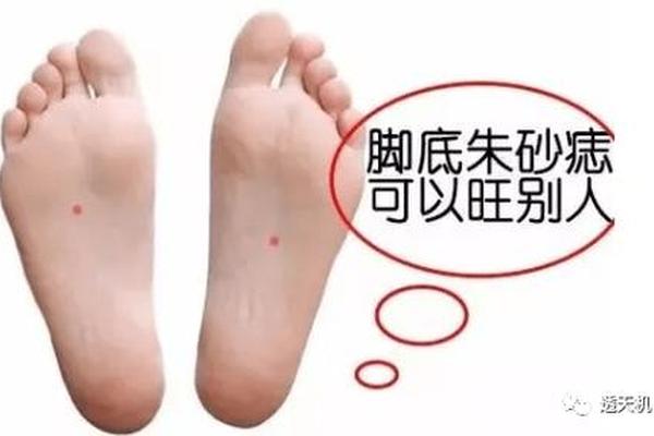 左脚心有痣贵人之相_男人左脚心有一颗痣