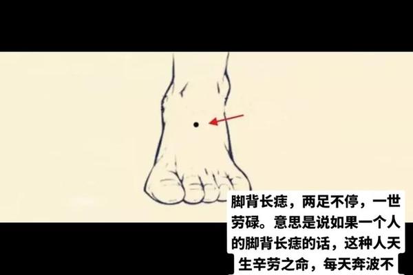 男人右脚外侧痣相—右脚侧面有痣代表什么