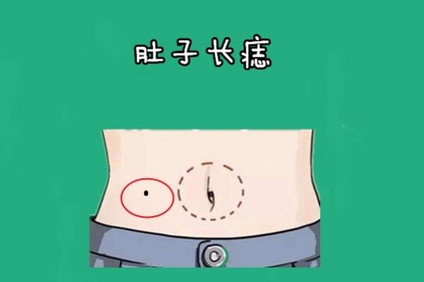 肚子长痣痣相解析;肚子有痣代表什么意思
