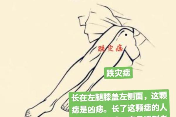 膝盖以上大腿有小痣相(右腿长痣)