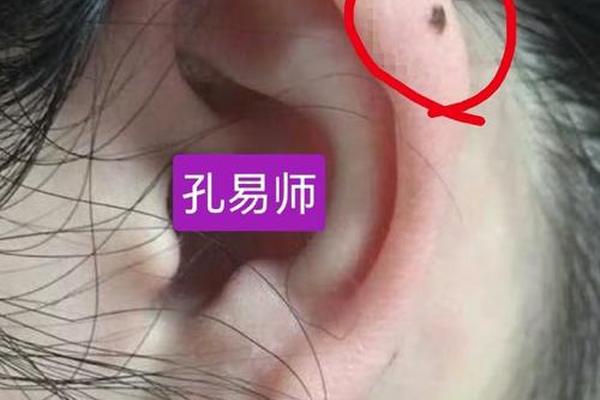 相学痣相说法,相学里耳朵会动的人