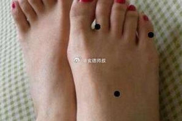 脚拇指背有痣的相法,大脚趾头长痣代表什么