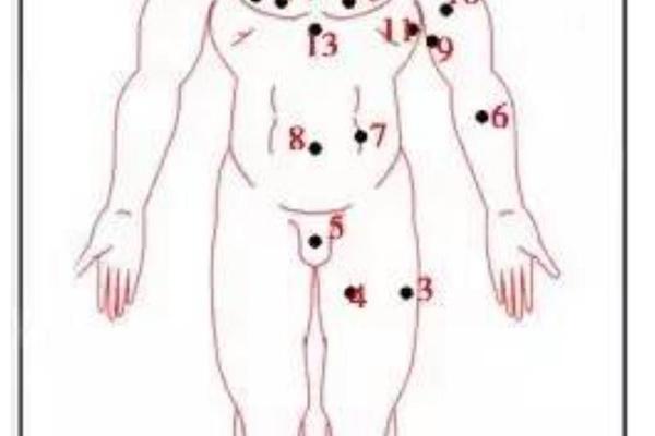 男人穷痣相;男人大腿内侧有巨富痣
