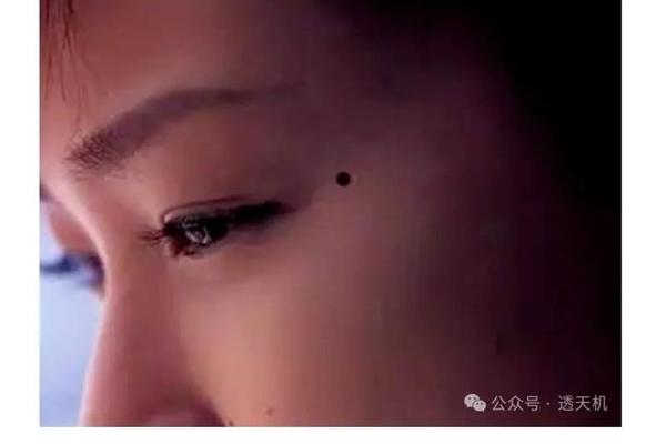 两痣相两个字怎么写;鼻子上有两颗痣