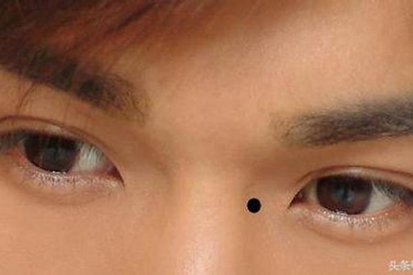 左眼角长痣相;左边眼角有个痣 左眼角长痣相;左边眼角有个痣