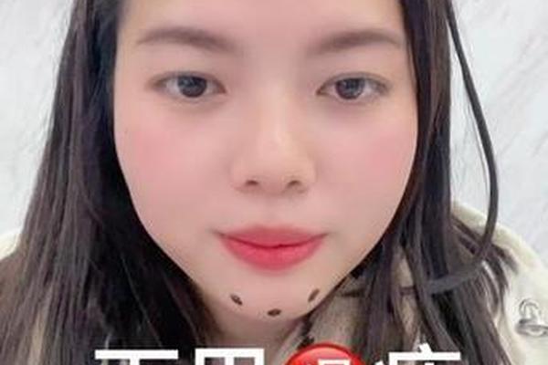 痣相下巴底有痣 下巴最下面有痣