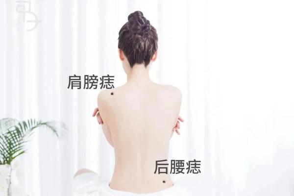 女人腰间痣相全解腰上痣 女人左腰上有痣
