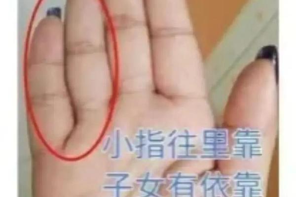 指尖痣相_小手指痣的位置与命运