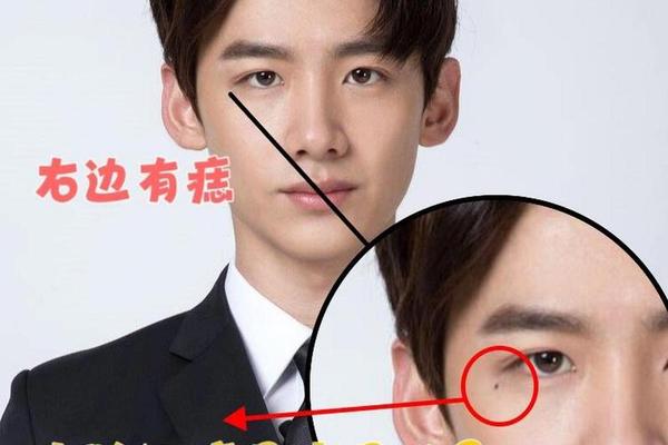 男人右眼睑痣相最准图;男人右眼皮上长痣好吗