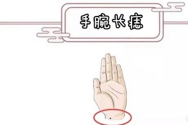 手腕痣相详解(手腕上方有痣代表什么) 手腕痣相详解(手腕上方有痣代表什么)