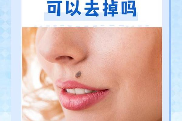 毛痣相(长毛痣代表什么意思)