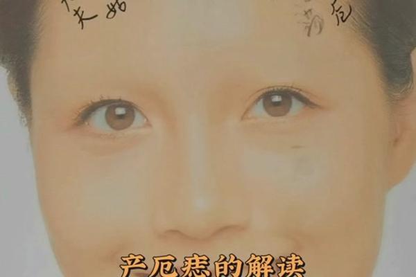 铁关刀痣相、刀厄痣